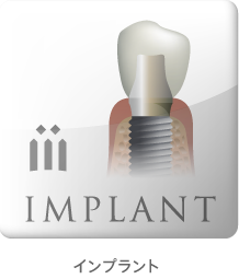 インプラント